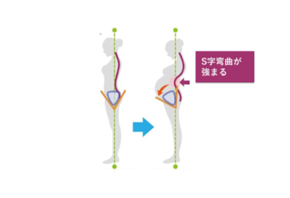 脊柱の図２