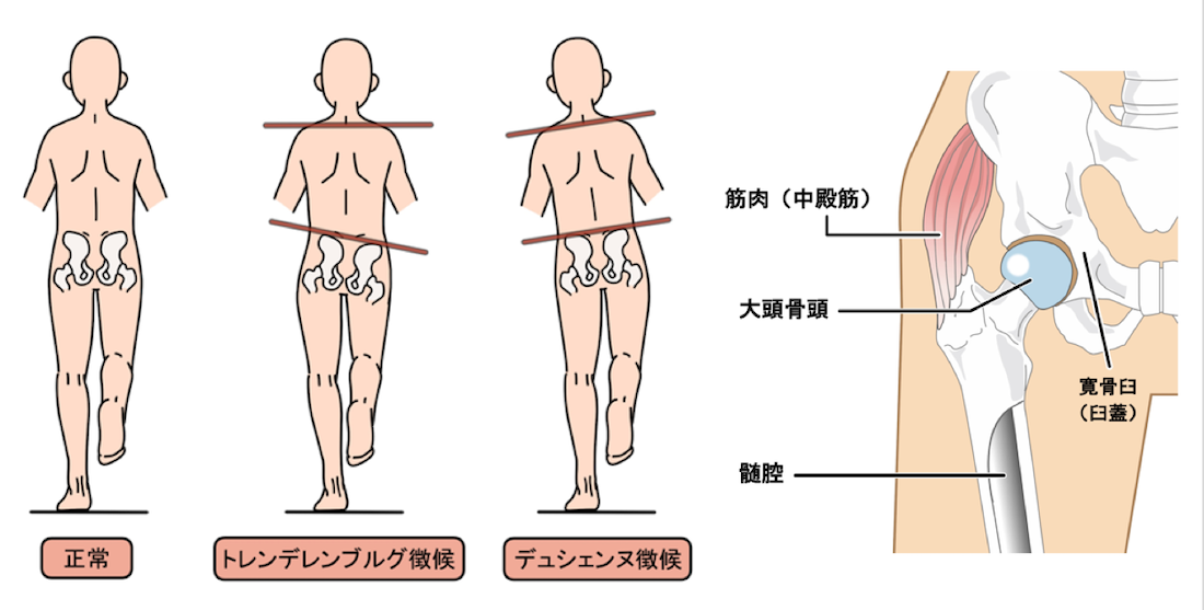 中殿筋の役割